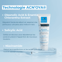 Acne Black Skin: ACN'OYA, Anti-imperfection care | IN'OYA Acne Black Skin: ACN'OYA, Anti-imperfection care | IN'OYA