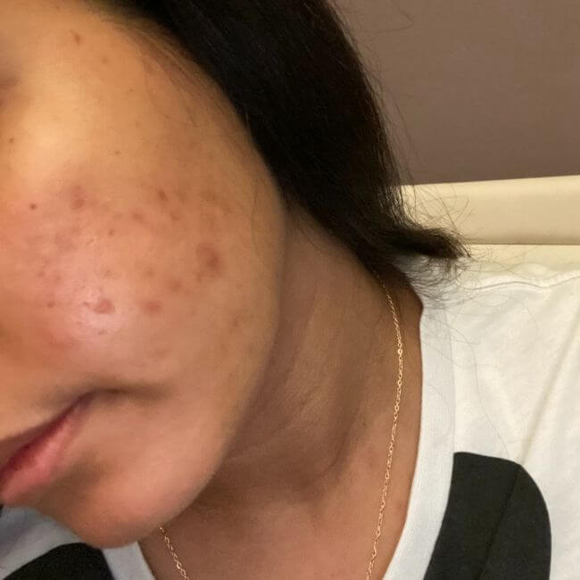 brown spots on matte skin