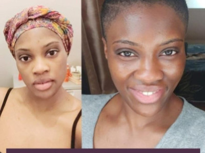  Why and how I stopped lightening creams - Marie's testimony