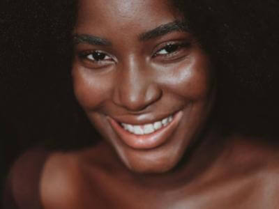 Brown spots scars on black skin- Juliette, 27 yo