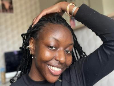How I treated my acne ? Fatoumata, 20 yo