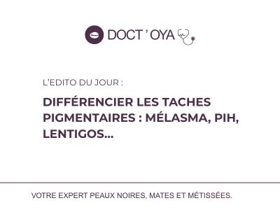 Différencier les taches pigmentaires : mélasma, PIH, lentigos…