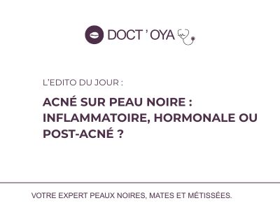Acné sur peau noire : inflammatoire, hormonale ou post-acné ?