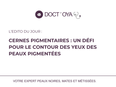 Cernes pigmentaires : un défi pour le contour des yeux des peaux pigmentées