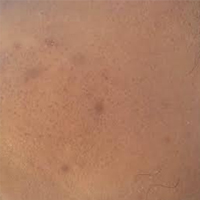 IN'OYA products help me get a beautiful smooth skin