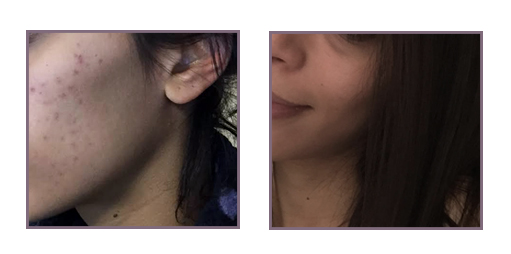 I finally got rid of my dark spots with IN'OYA