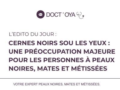 Cernes noirs sous les yeux : une preoccupation majeure 
