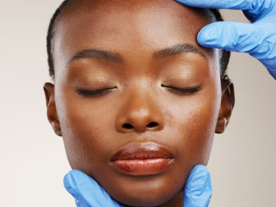 Botox Preventif et Soins Anti-Age pour Peaux Noires et Metissees 