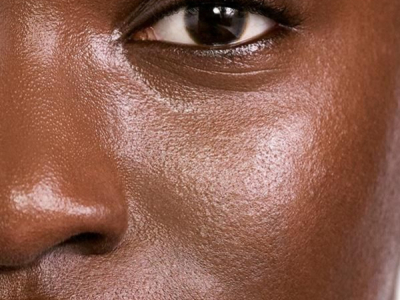 Comment choisir un bon matifiant visage pour une peau grasse ?