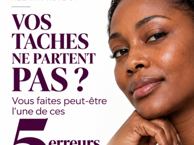 Vos taches noires ne partent pas ? 