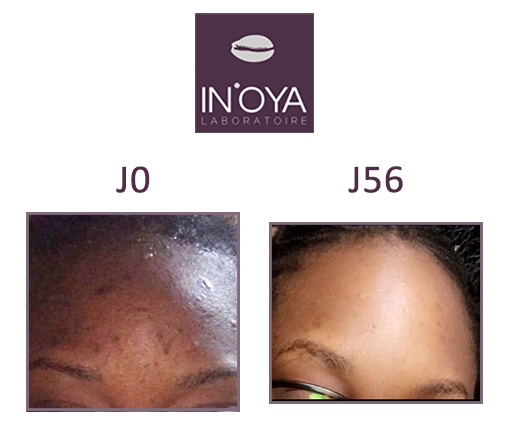 A faithful OYA very satisfied with the results of efficiency