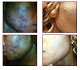 My skin has transformed!