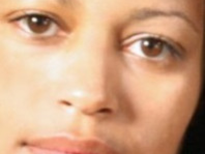Keloid Scars on Black Skin: Treatment & Tips