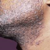 Maintenance of the Black Man's Skin and Mate