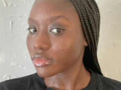 Dark Circles & Hyperpigmentation of Black Skin