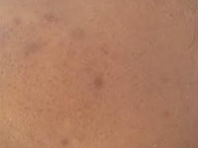 Les produits m'ont permis d'avoir une belle peau lisse
